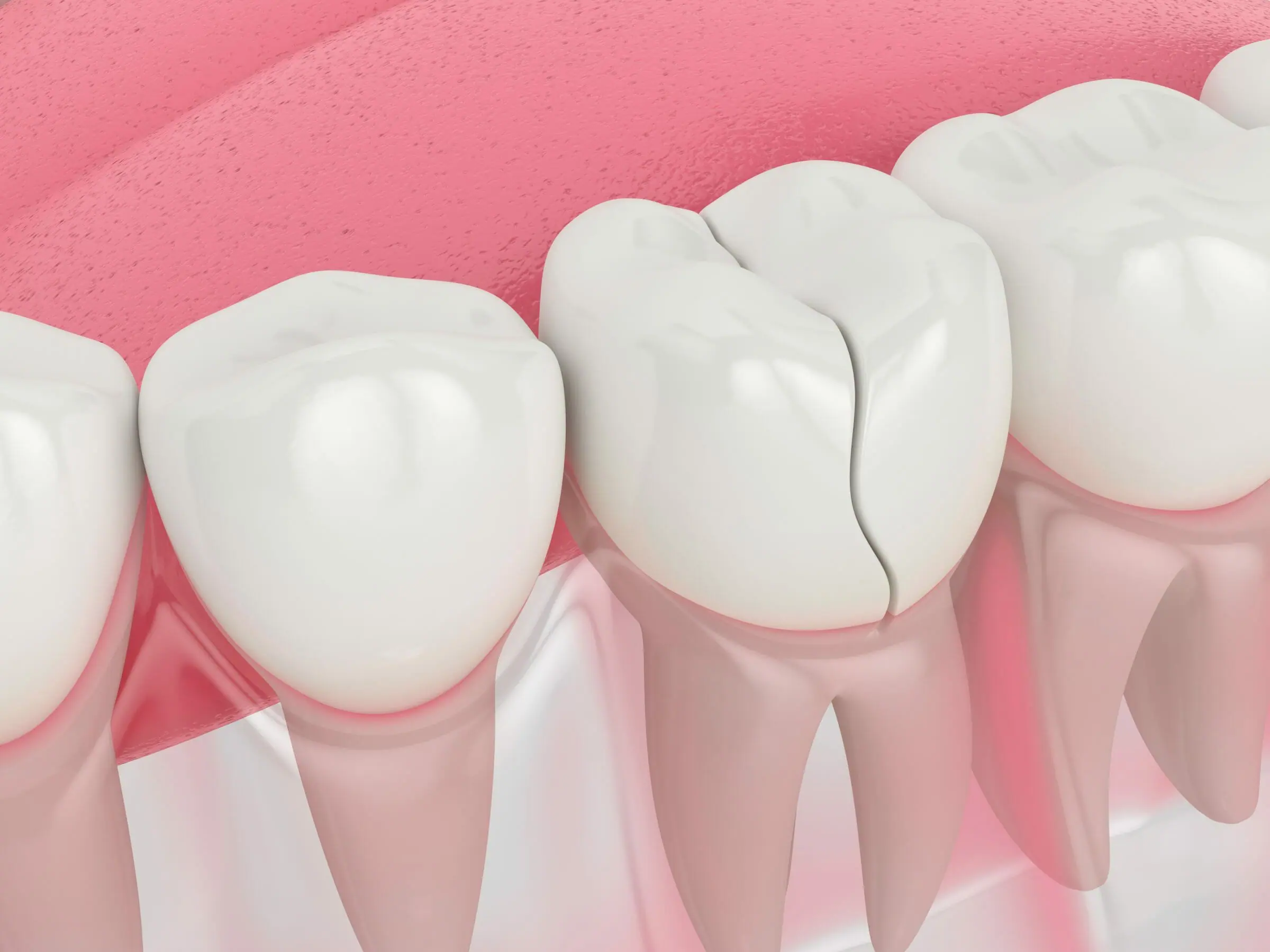 Tooth