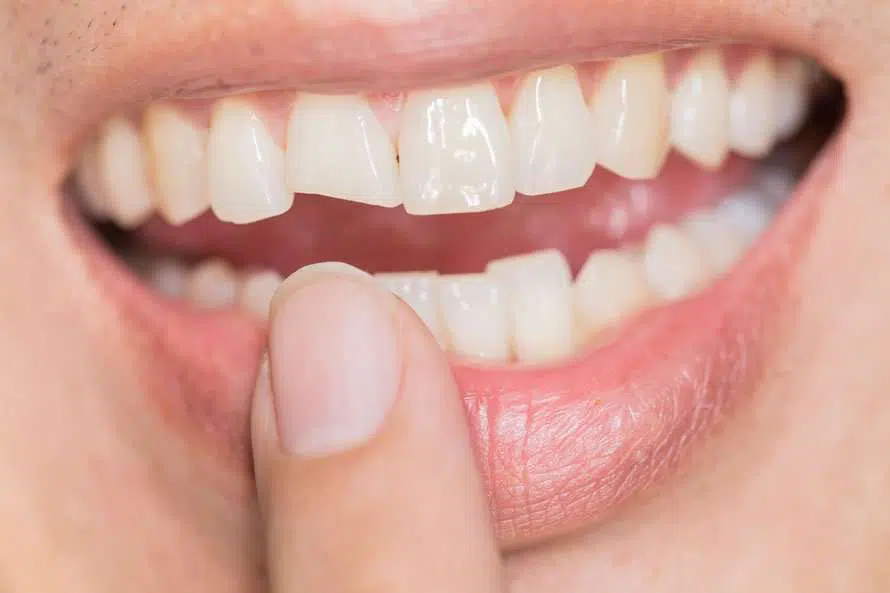 Tooth